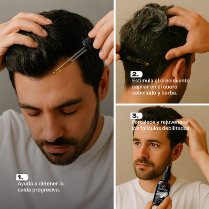 Combo Control Caída CMS Cosmos Bioxin 5